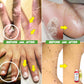 Trending: Mole & Warts Remover, Skintags, Syringoma, Kalyo & More... 🎁FREE Scar Remover